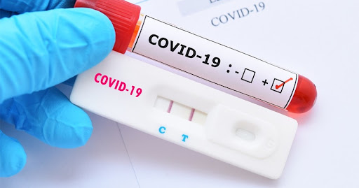 Ampla ação de testagem para Covid-19 acontece nesta quinta-feira (30)