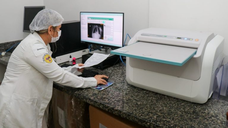 Investimento em Saúde: UMMI conta com um Digitalizador de Raio-X para facilitar diagnósticos de pacientes